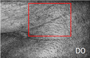 Hair Growth Scalp Serum in-vivo study panel - Hair parting, day 0