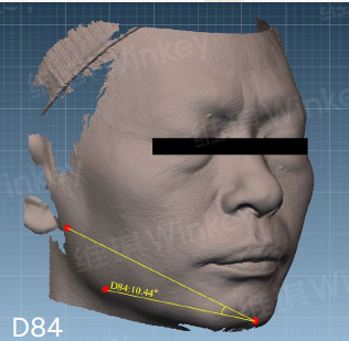 Hair Growth Scalp Serum in-vivo study panel - Jawline lifting and tightening, day 84