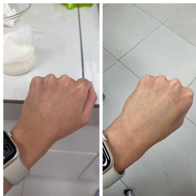 Instant Brightening Toner Pad in-vivo study panel - Before