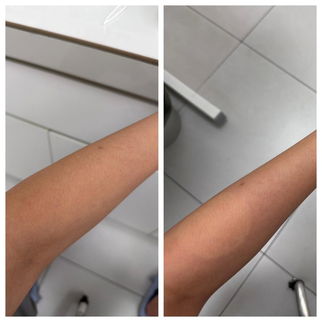 Instant Brightening Toner Pad in-vivo study panel - After 15 minutes